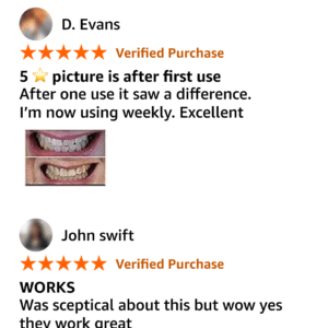 V34 Whitening Strips